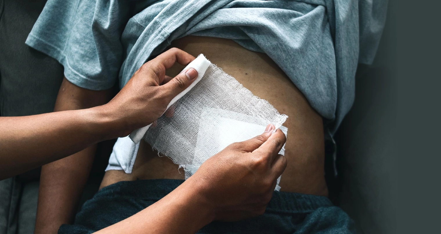 Penyembuhan Luka yang Terlambat (Delayed Wound Healing)