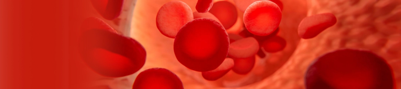 Myelodysplastic Syndrome (MDS)