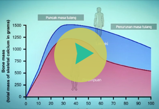 Video Informasi Pencegahan Osteoporosis