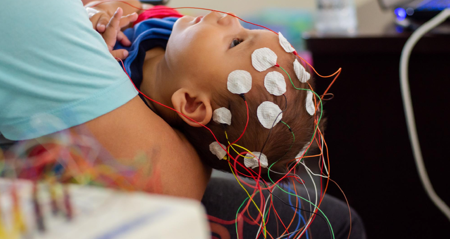Pemeriksaan EEG (Electroencephalography)