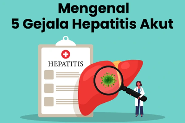 Mengenal 5 Gejala Hepatitis Akut