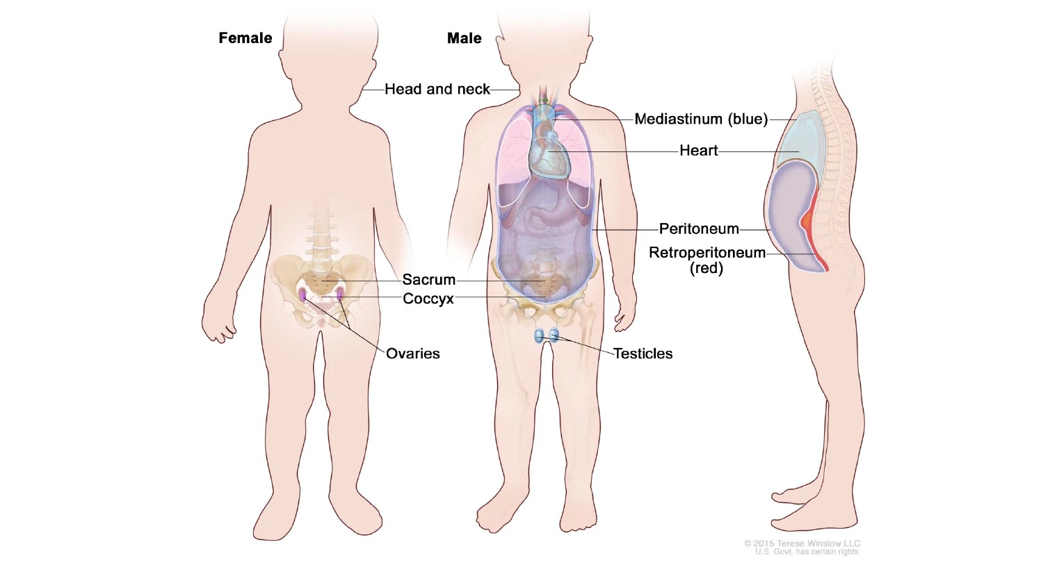 Tumor Sel Germinal