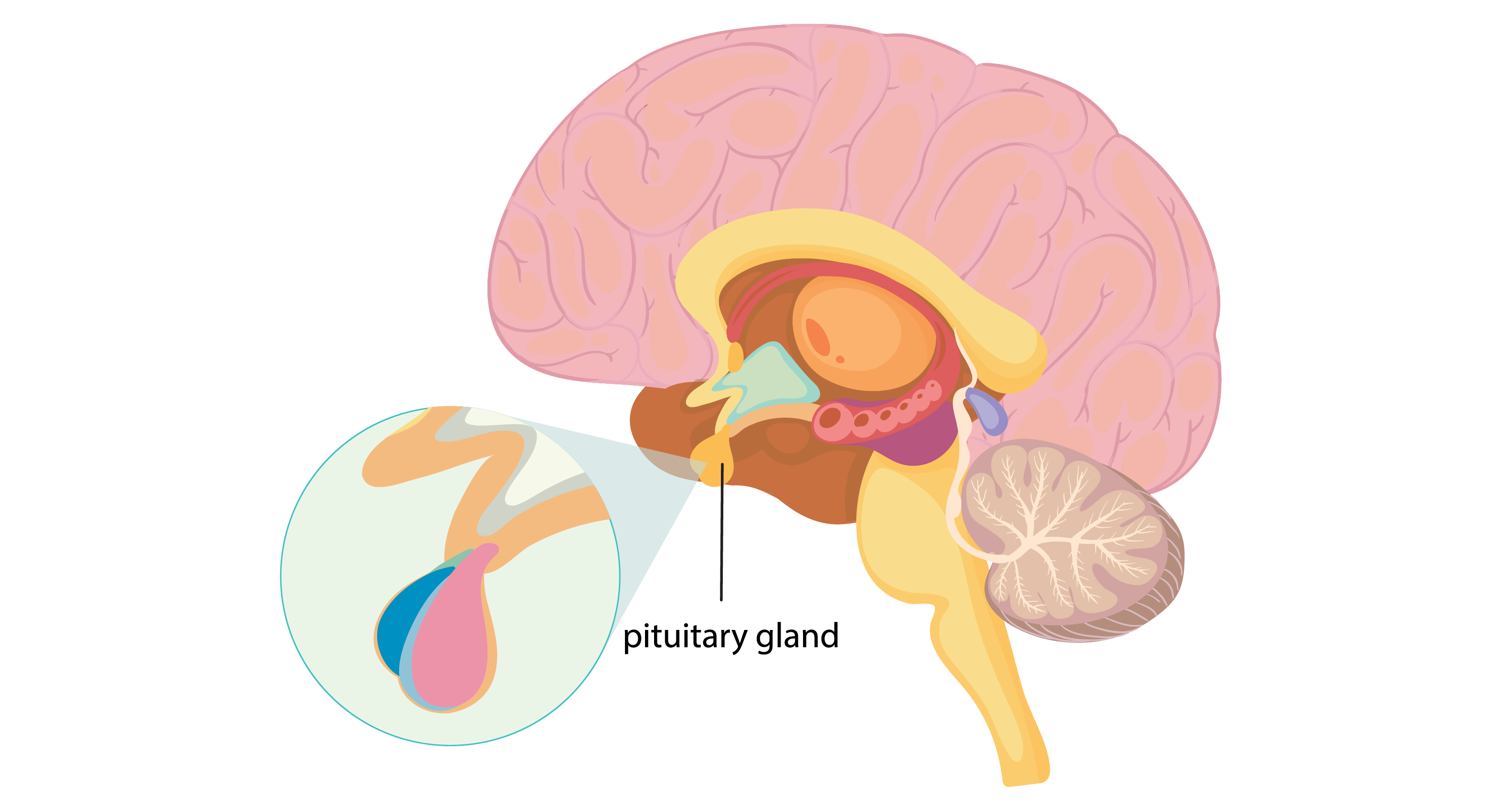 Tumor Pituitari: Kecil Ukurannya, Besar Perannya!